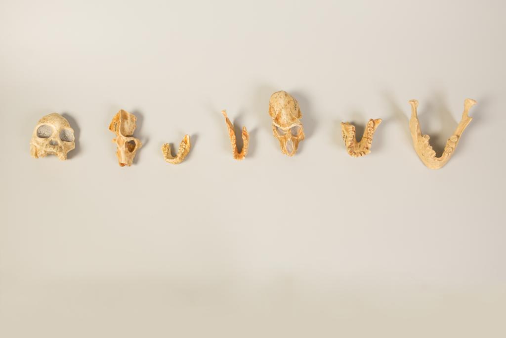 ensemble (16) de la collection de crânes humains